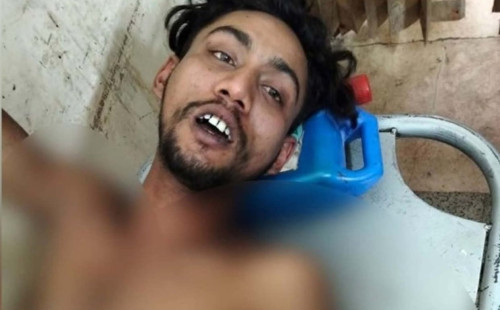 বাঘারপাড়ায় ছেলেকে কুপিয়ে যখম করল পিতা