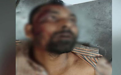 যশোরে প্রতিবন্ধী রিক্সাচালককে কুপিয়ে জখম