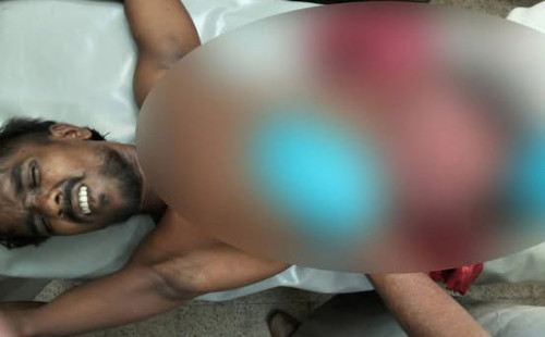 যশোরে ছোট ভাইয়ের ছুরিকাঘাতে বড় ভাই আহত